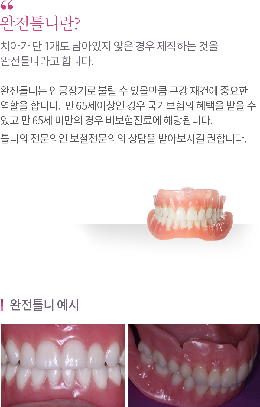 완전틀니 내용